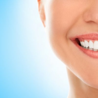 dental veneers costa rica feature
